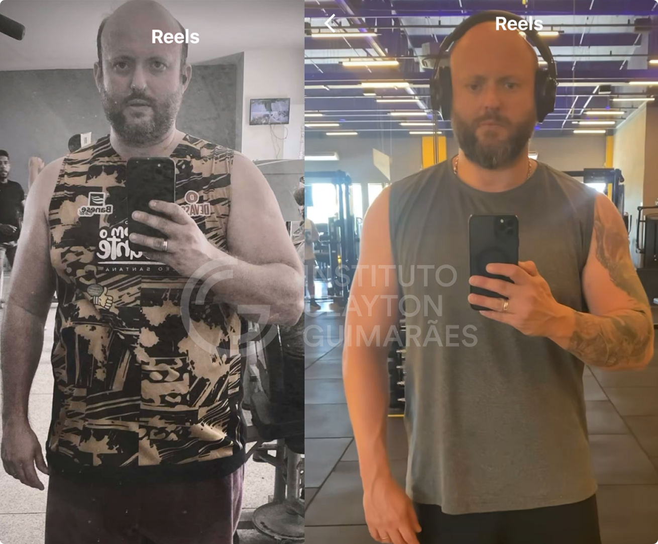 Antes e depois 4