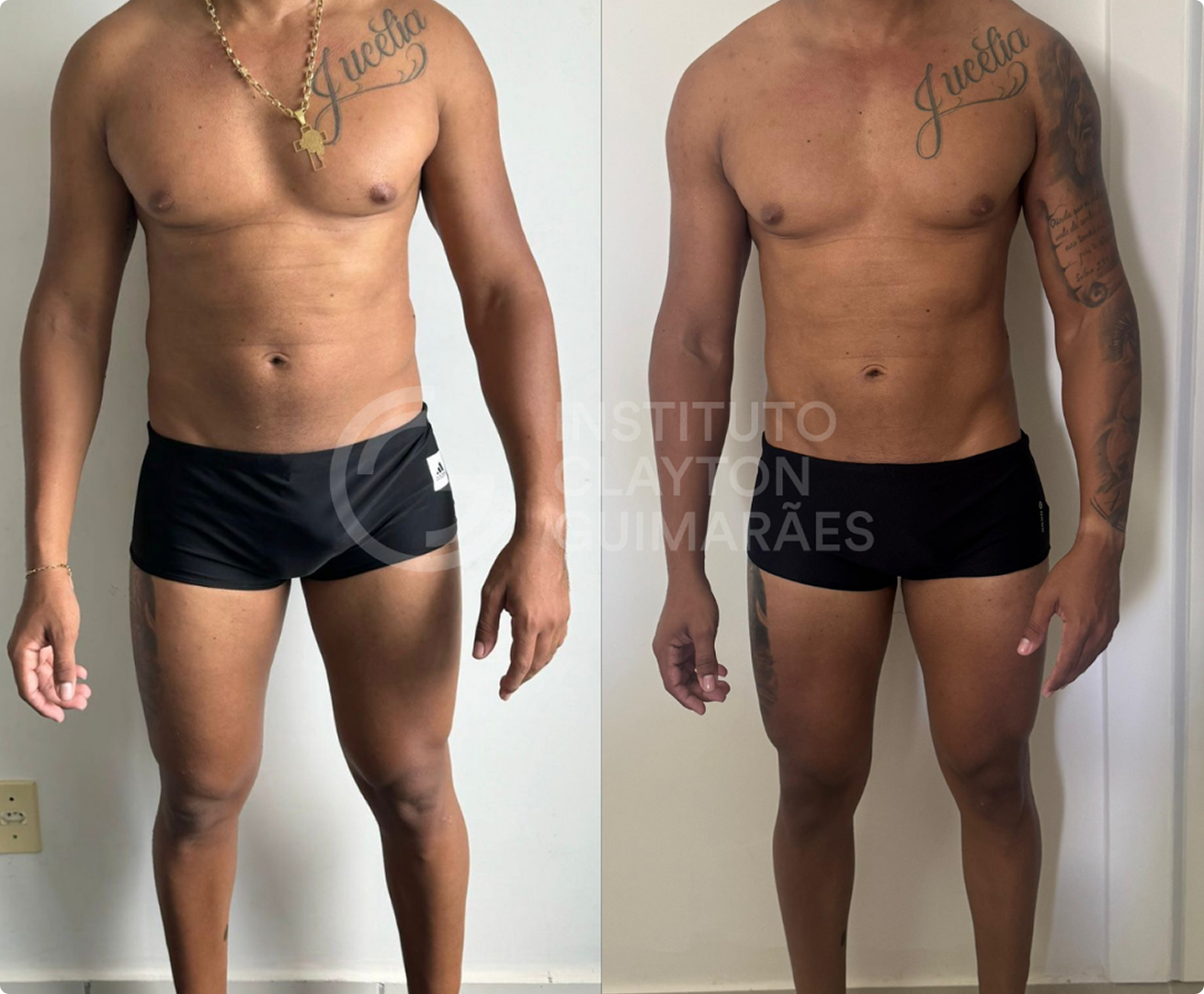 Antes e depois 3