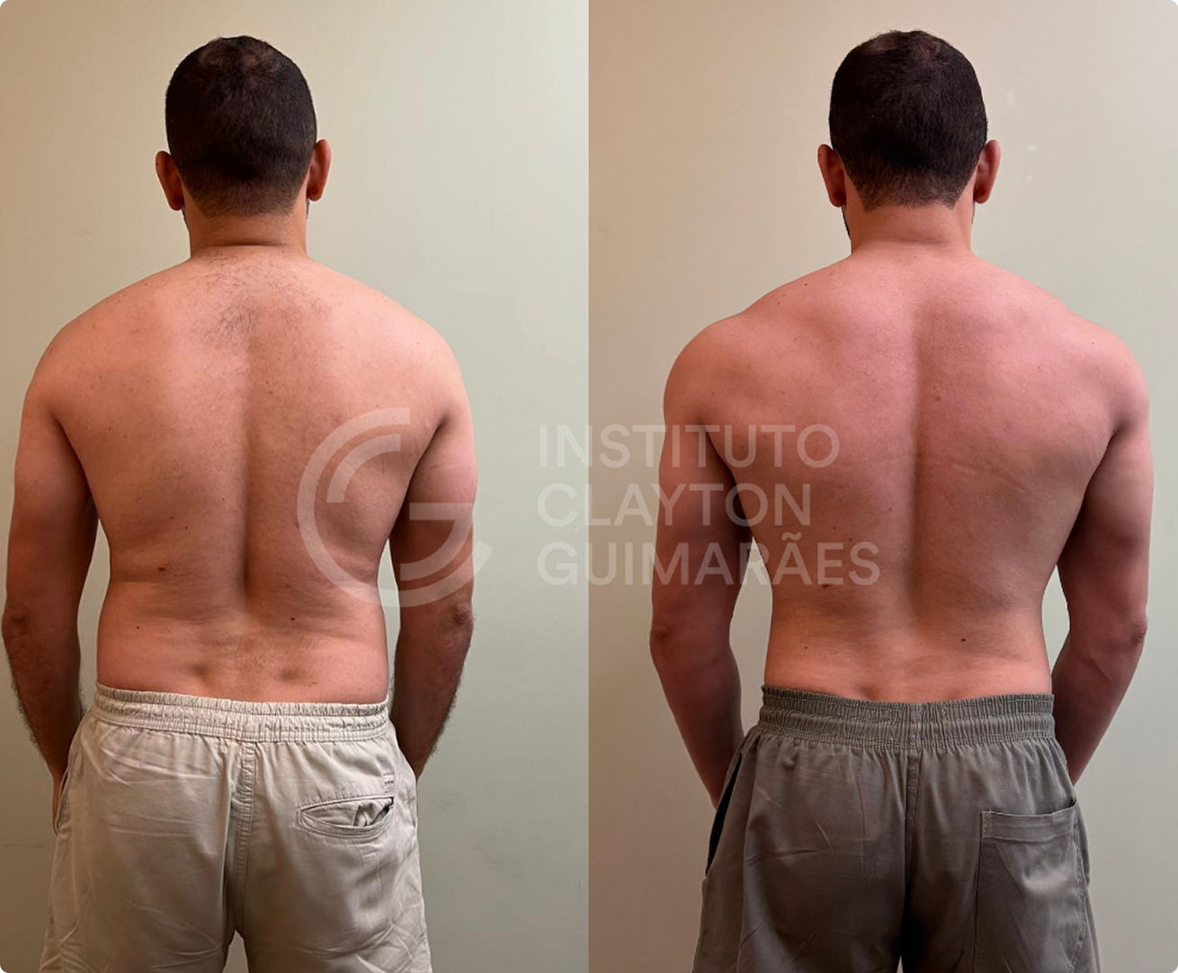 Antes e depois 2