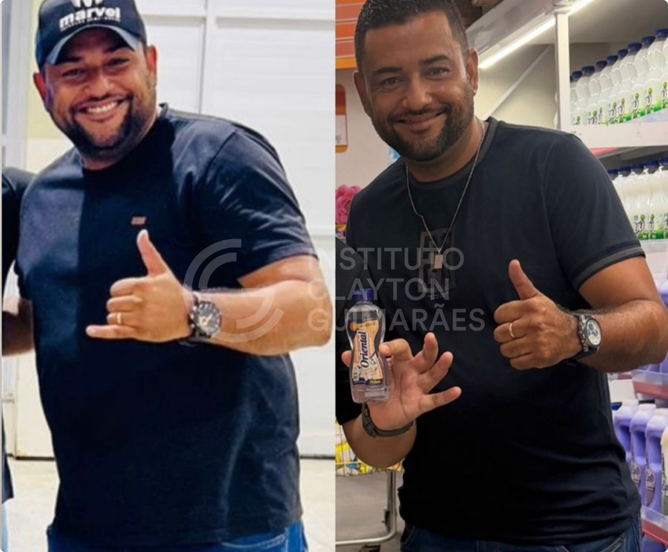 Antes e depois 5