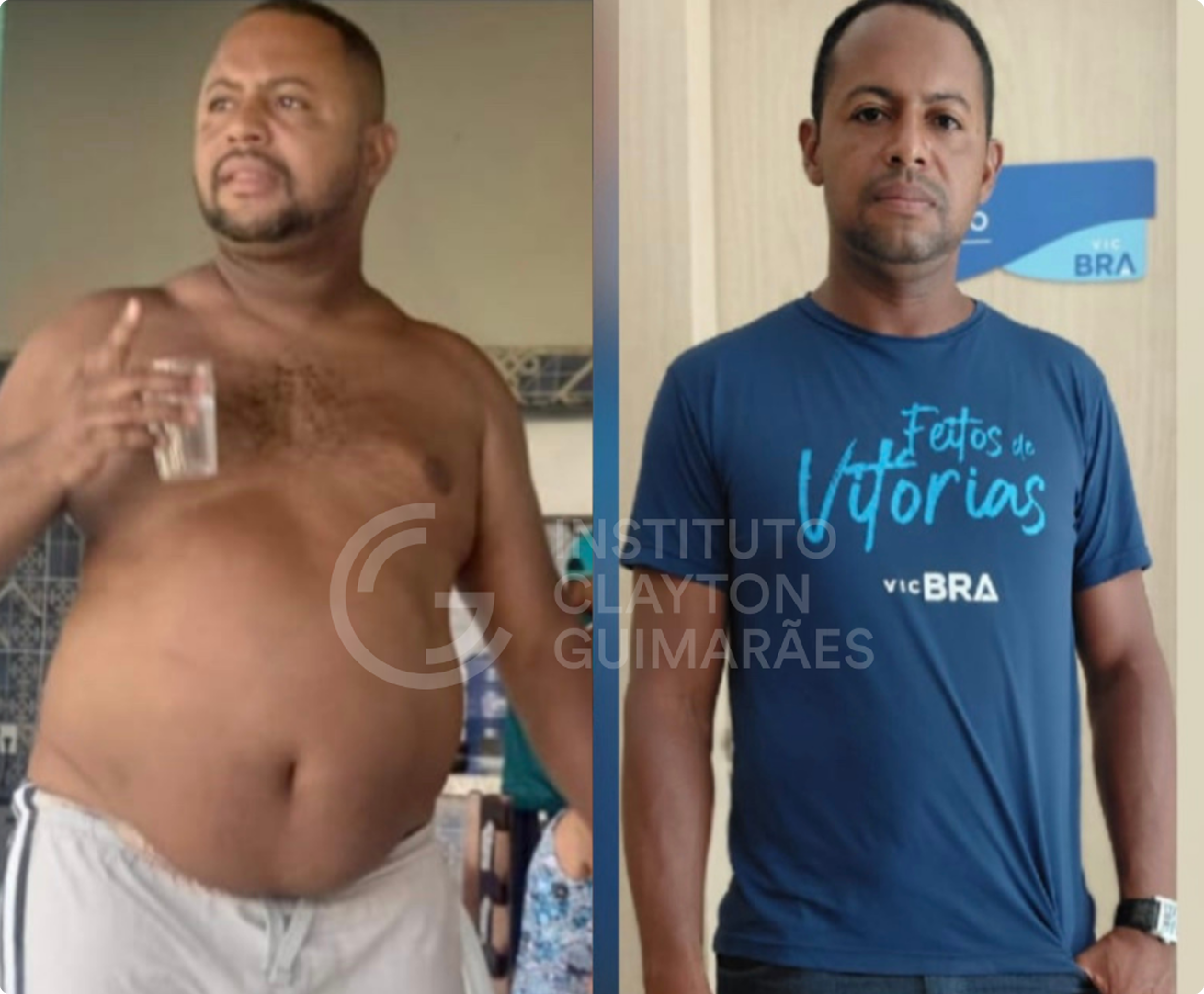 Antes e depois 4