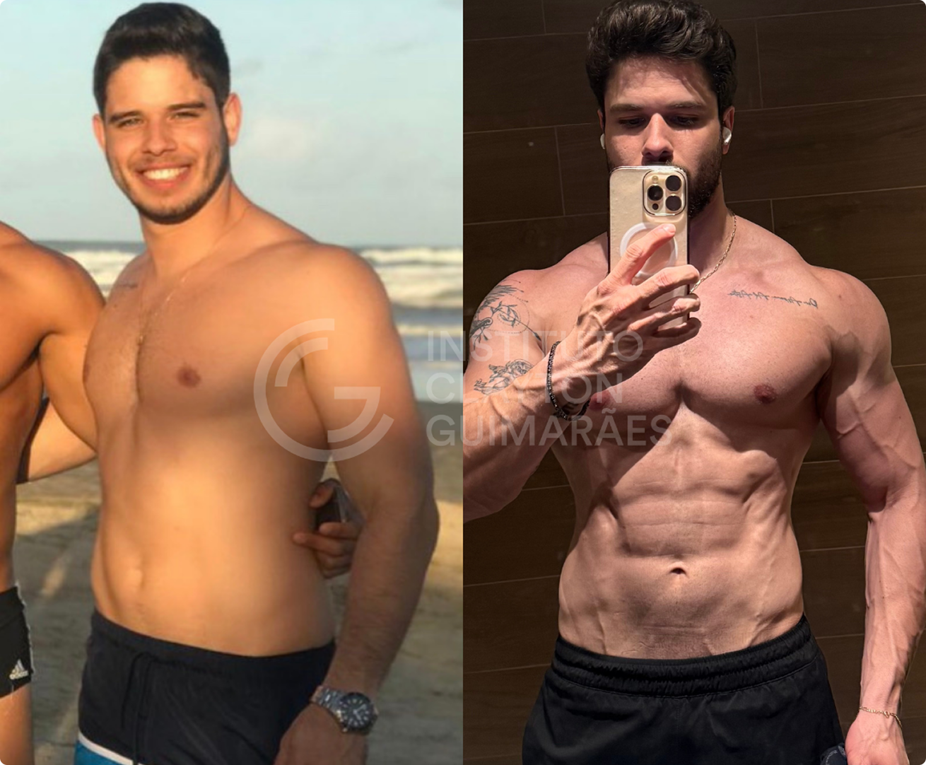 Antes e depois 5