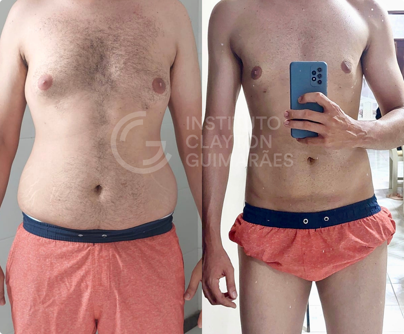 Antes e depois 4