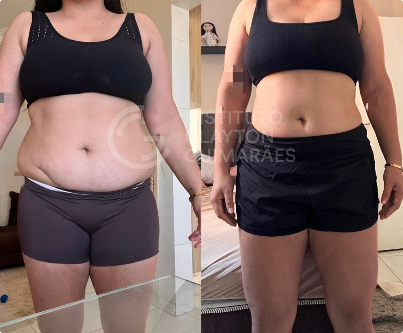 Antes e depois 3