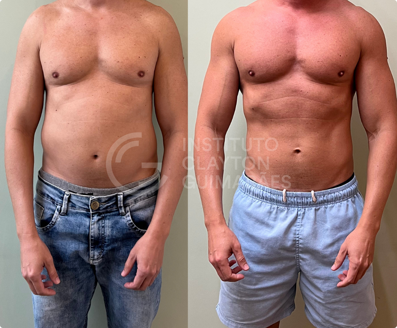 Antes e depois 2