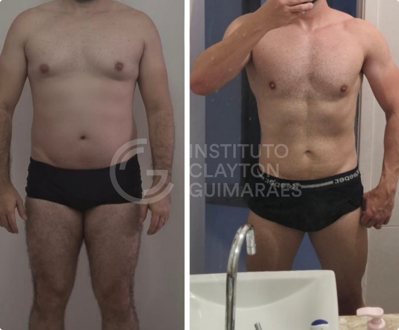 Antes e depois 1