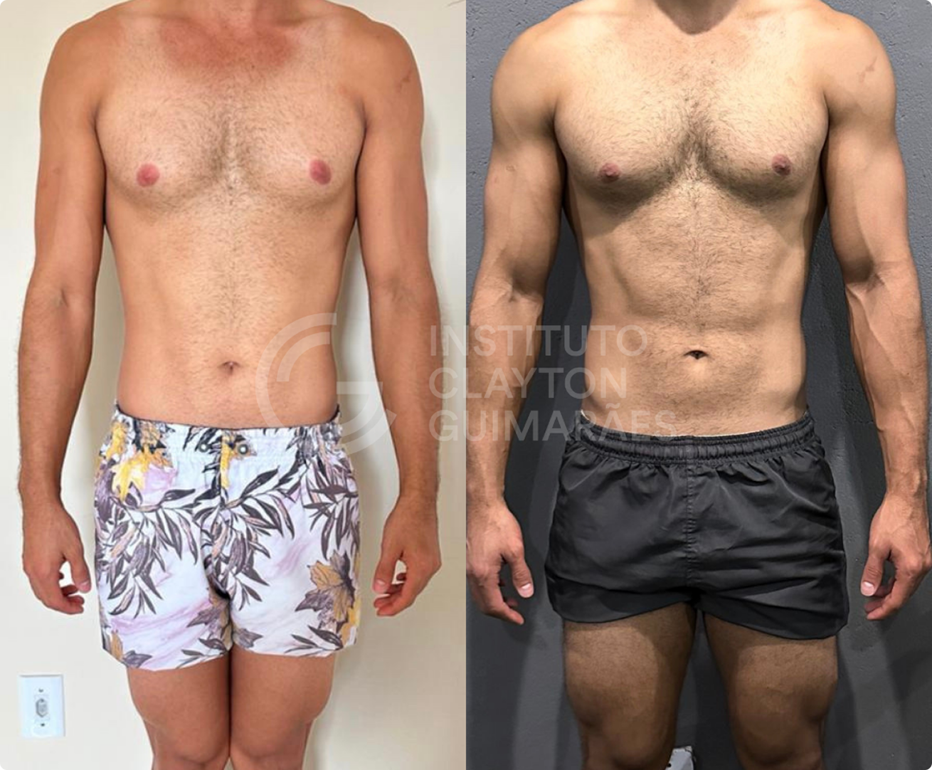 Antes e depois 5